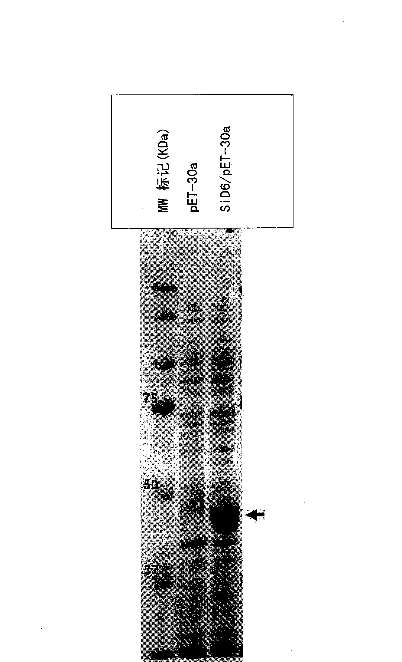 Lignans hydroxylase