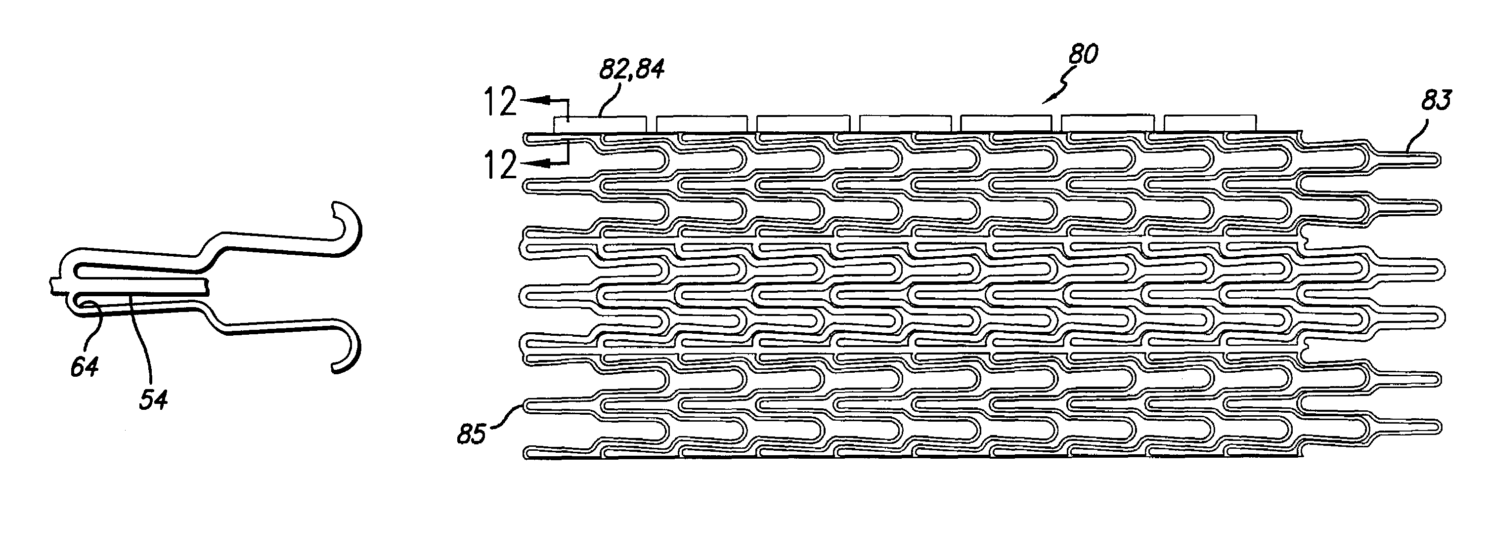 Intravascular stent for treating vulnerable plaque and method of use