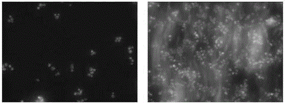 Method for increasing lipid content of diatom through metabolism gene engineering