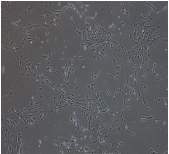 Method for efficiently separating intramuscular fibroblast-lipogenic progenitor cells of mouse