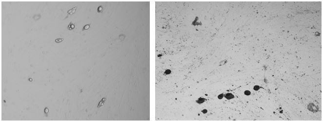 Method for efficiently separating intramuscular fibroblast-lipogenic progenitor cells of mouse