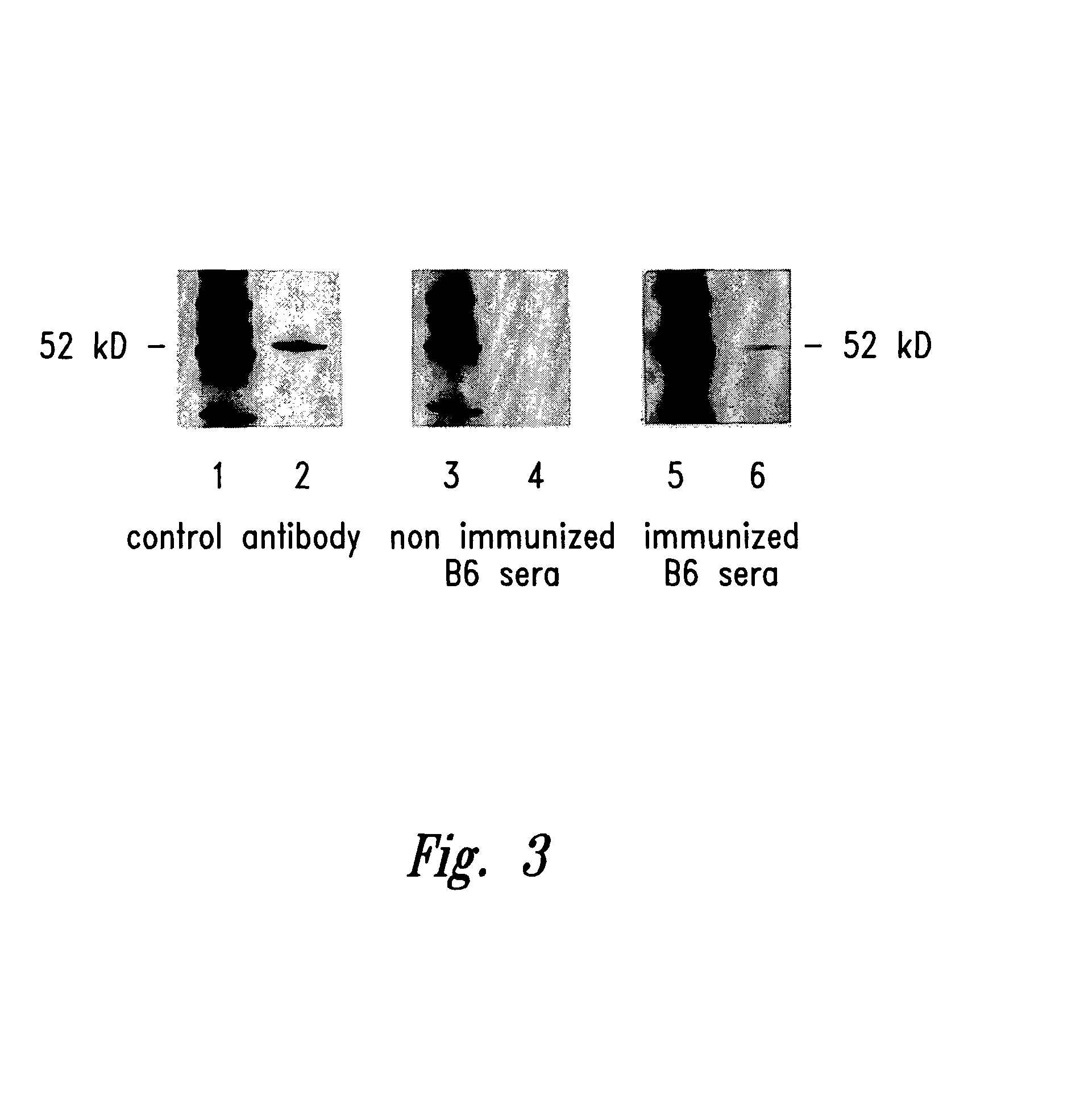 Compositions and methods for WT1 specific immunotherapy