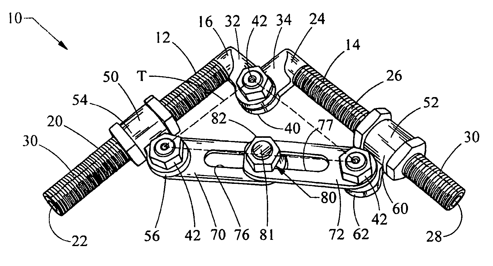 External fixation assembly