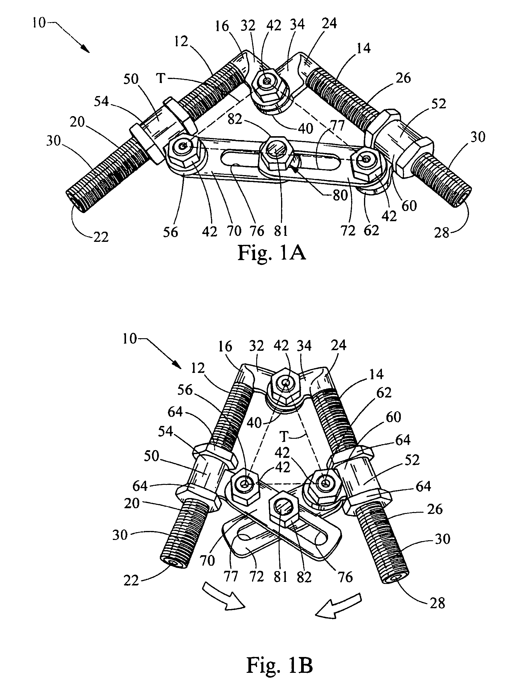 External fixation assembly