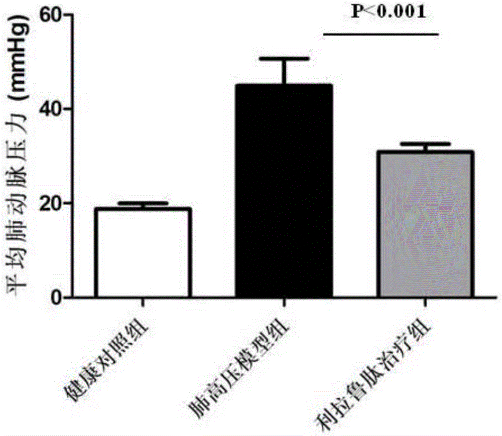 Application of glucagon-like peptde-1 receptor agonist to preparation of pulmonary hypertension treating medicine