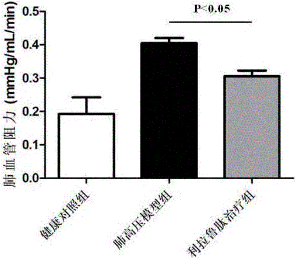 Application of glucagon-like peptde-1 receptor agonist to preparation of pulmonary hypertension treating medicine