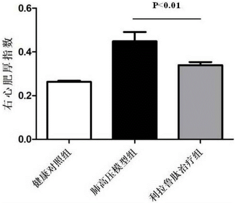 Application of glucagon-like peptde-1 receptor agonist to preparation of pulmonary hypertension treating medicine