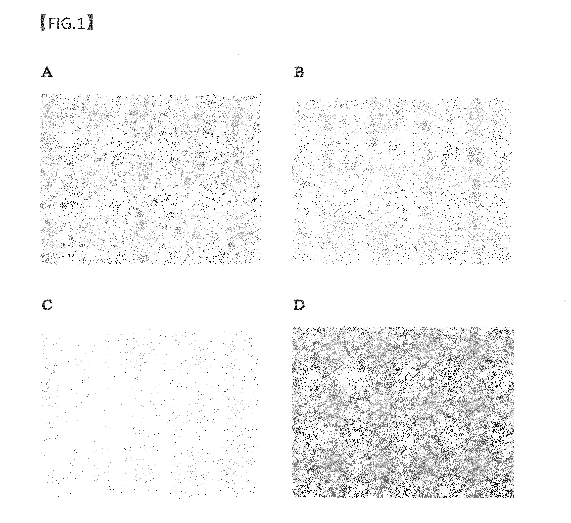 Method for detection of liver cancer cell using Anti-glypican-3 antibody