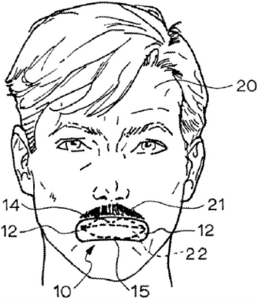 Anti-snoring device