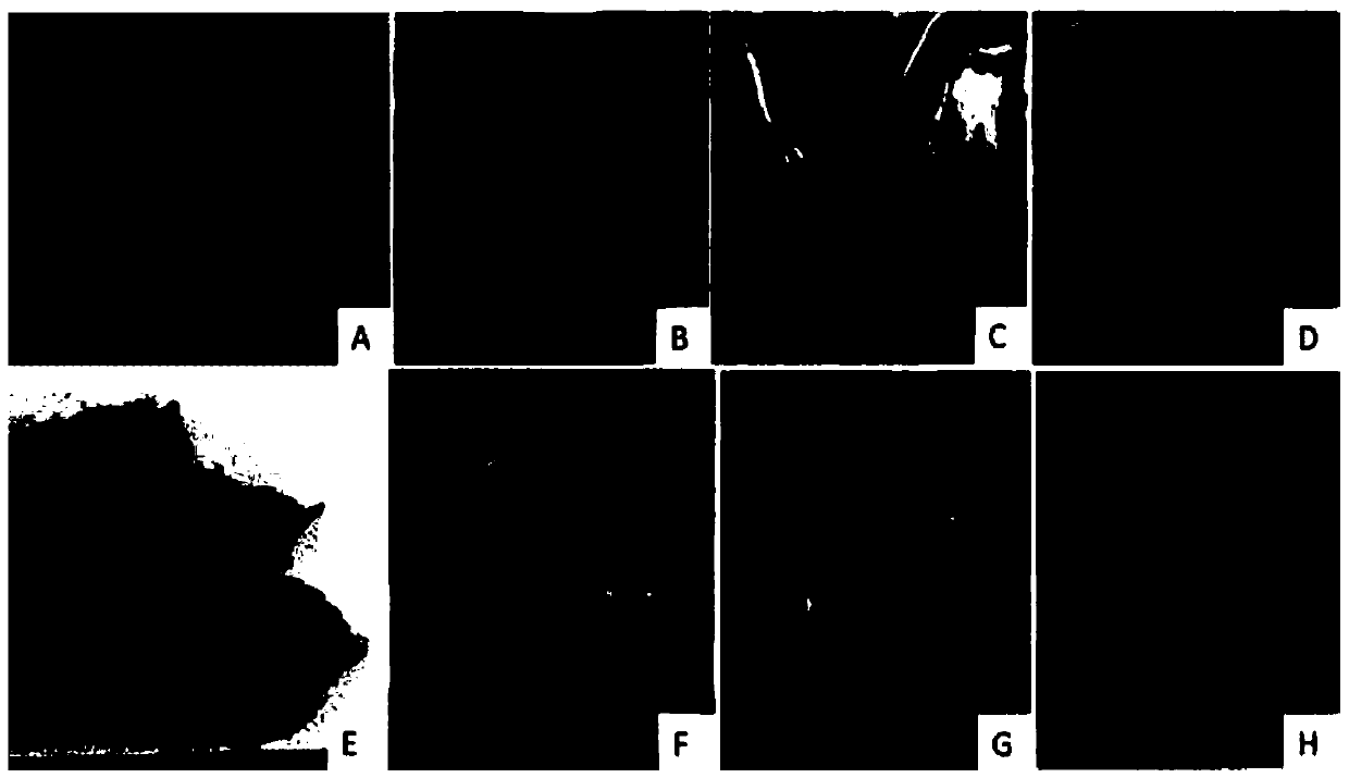 Rapid propagation method of tissue culture of female and male plants of Zhejiang hemsleya amabilis