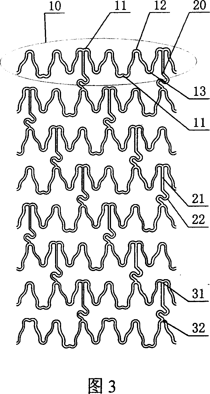 Blood vessel support bracket with little tissue prolapsus after implantation