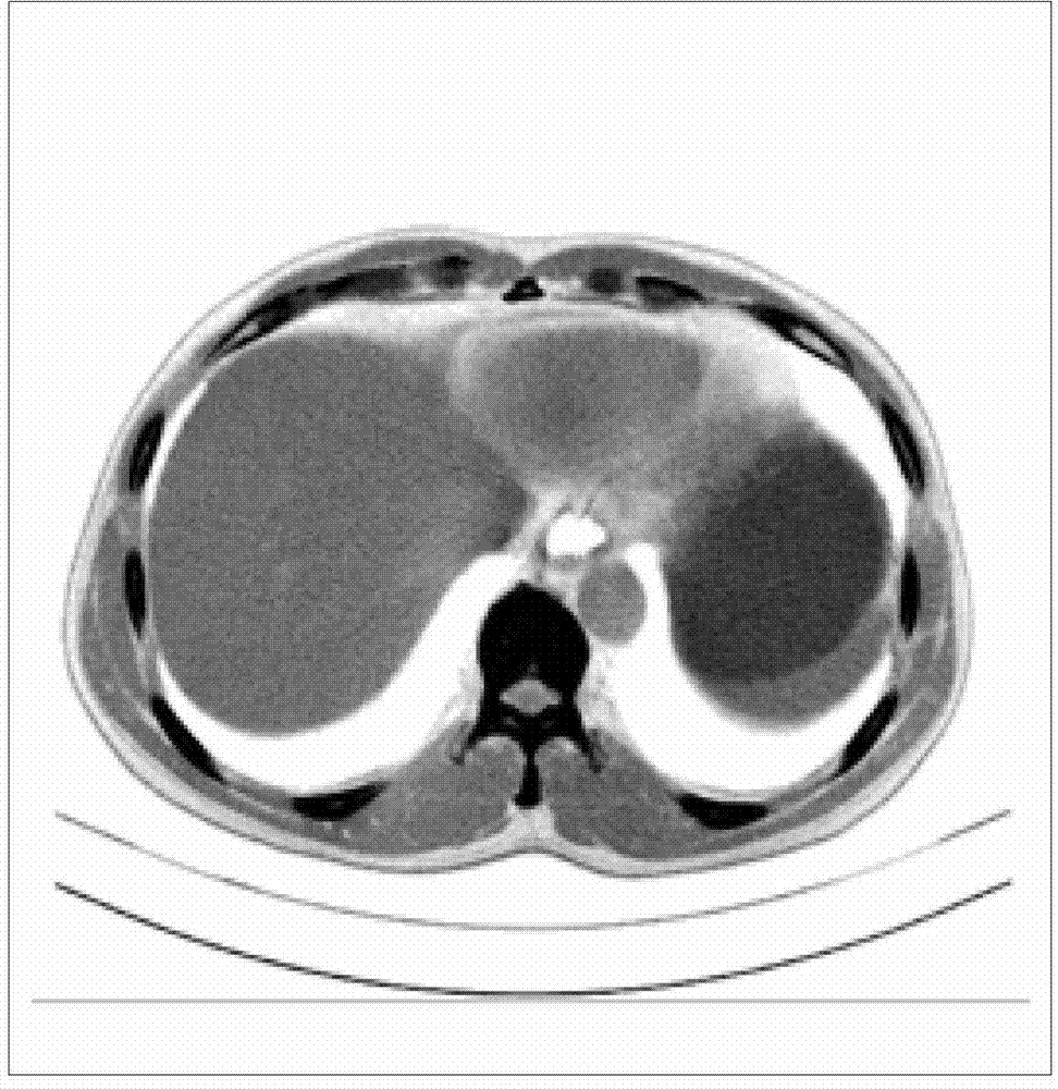 Medical image encryption method based on uniform scrambling and chaotic mapping