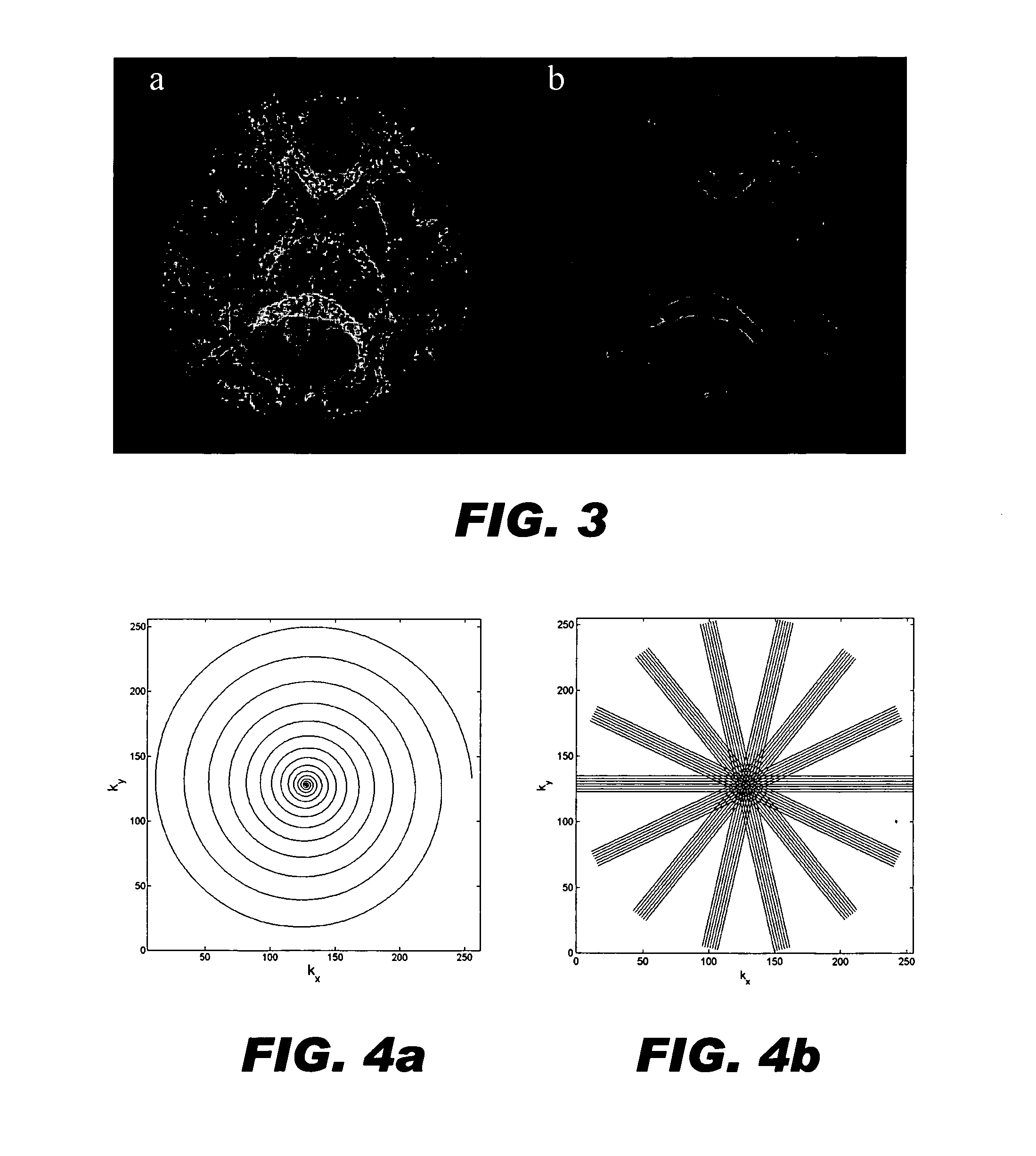 Generalized MRI reconstruction with correction for multiple image distortion