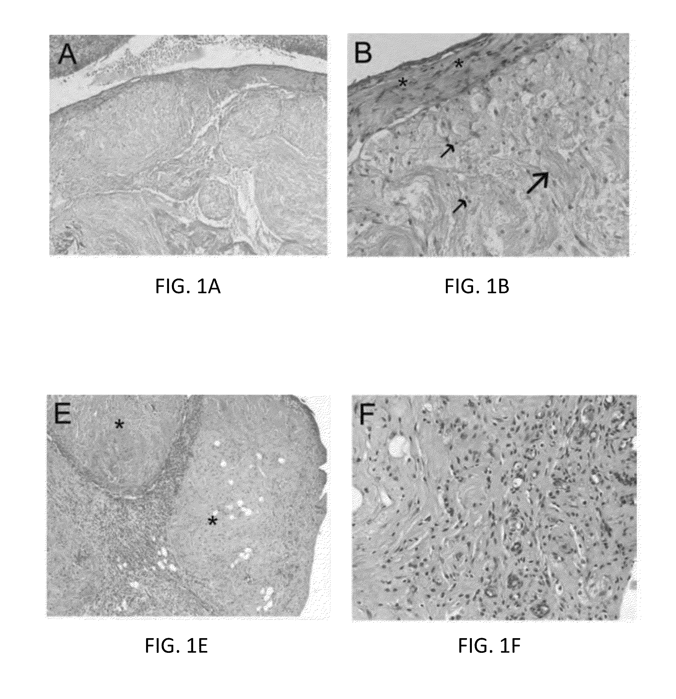 Treated neural tissue composition