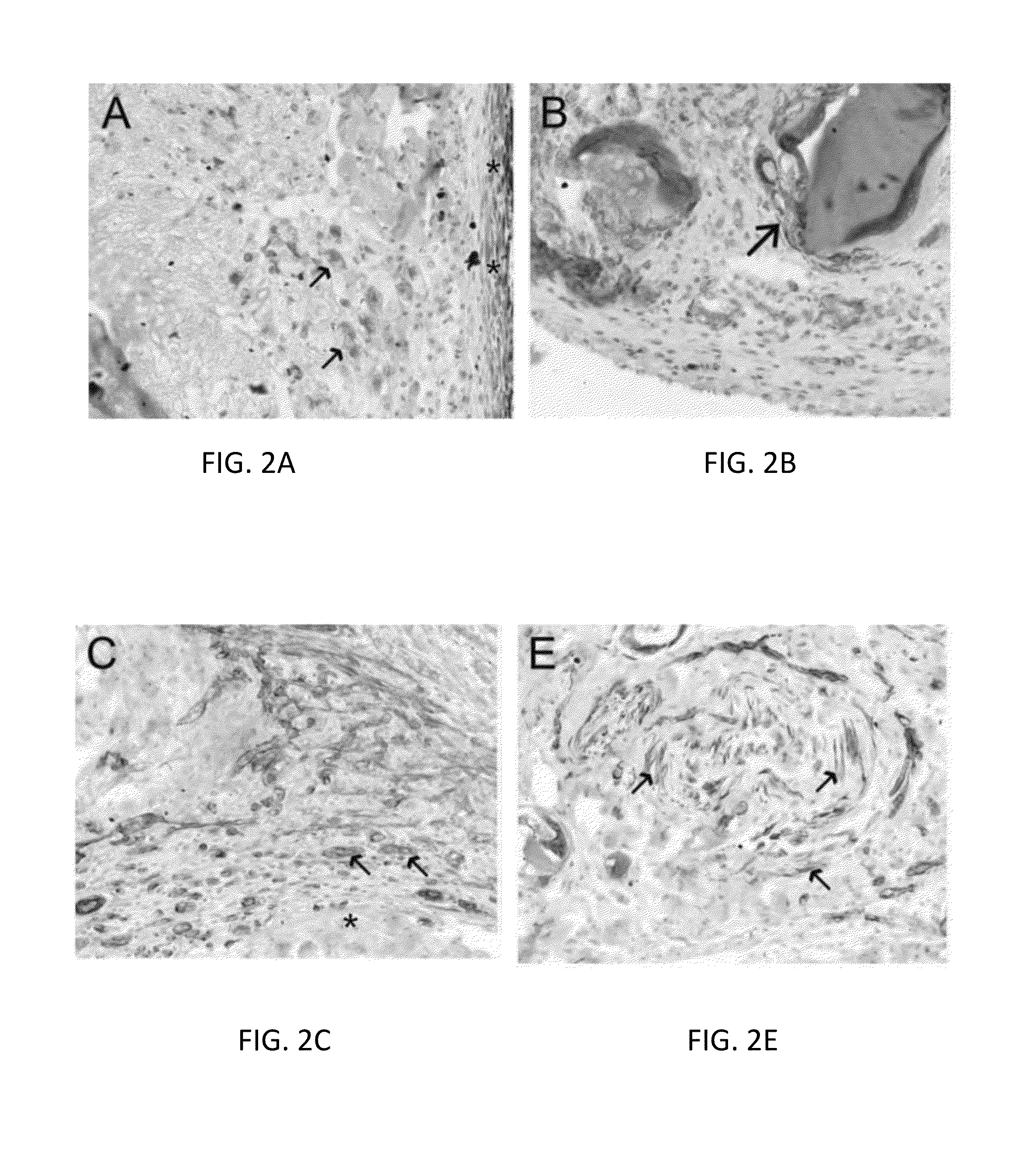 Treated neural tissue composition