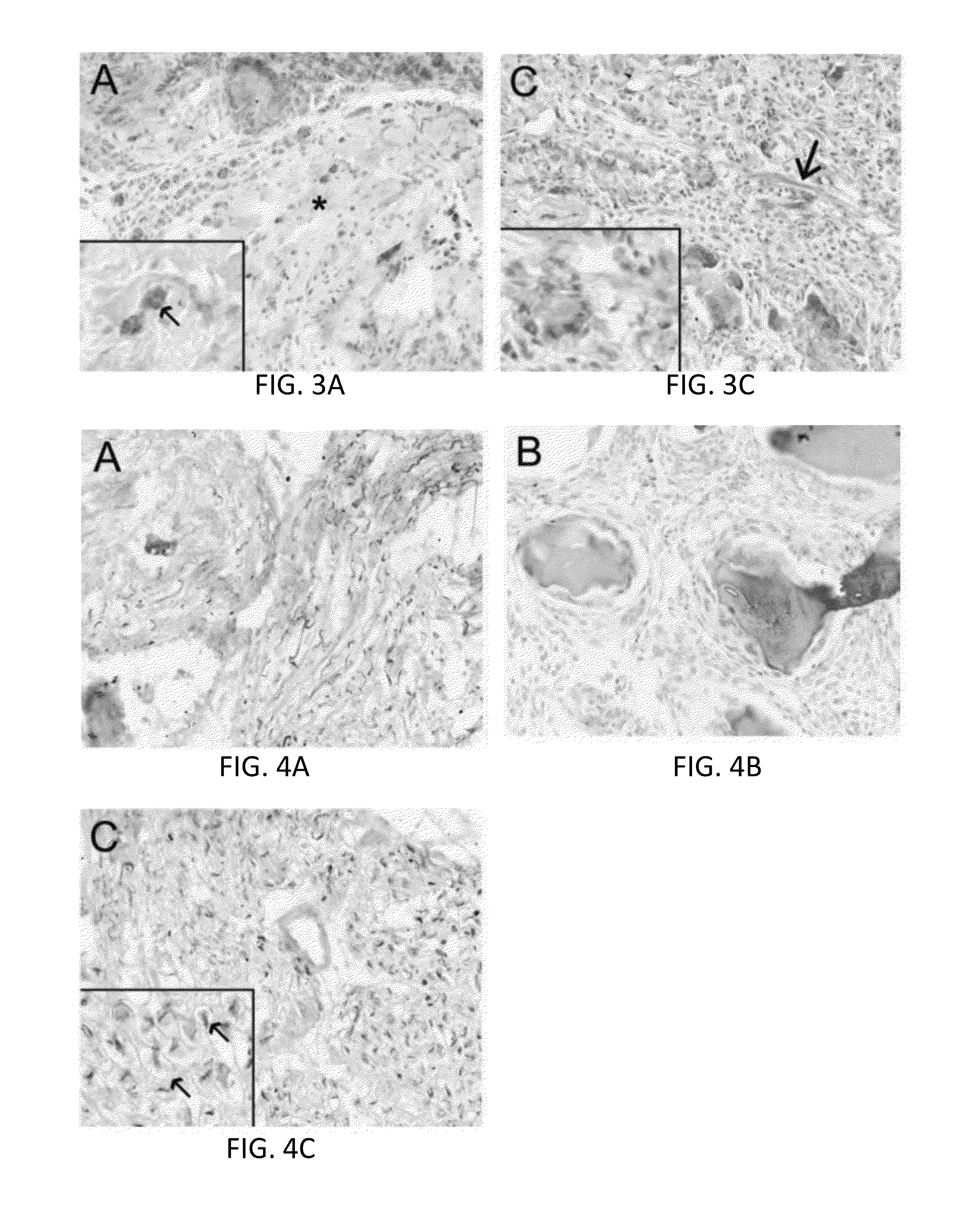 Treated neural tissue composition