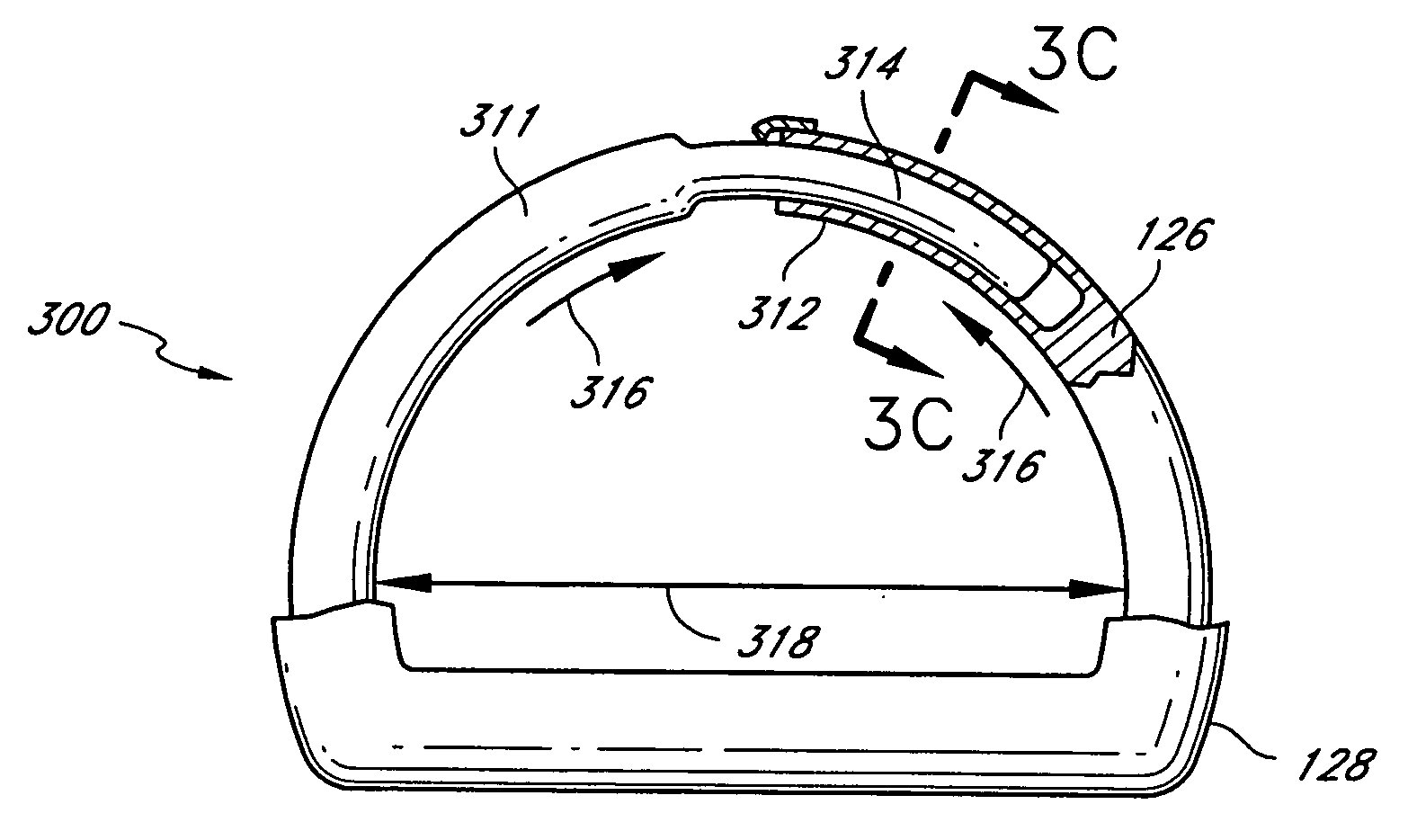 Thermal conductor for adjustable cardiac valve implant