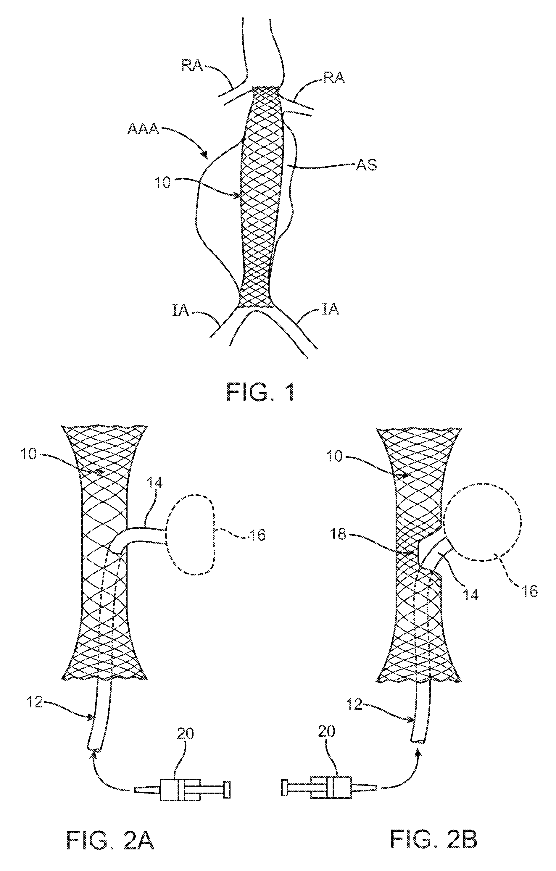 Methods and systems for aneurysm treatment using filling structures