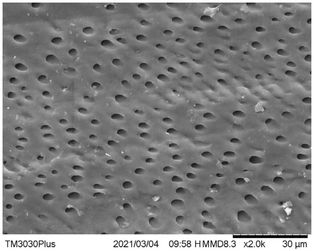 Composition capable of enhancing anti-dentin hypersensitivity effect of bioactive material as well as preparation method and application of composition