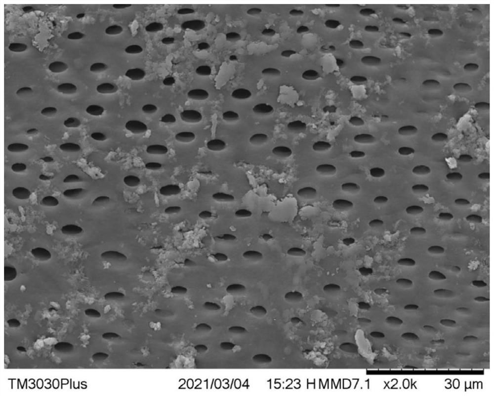 Composition capable of enhancing anti-dentin hypersensitivity effect of bioactive material as well as preparation method and application of composition