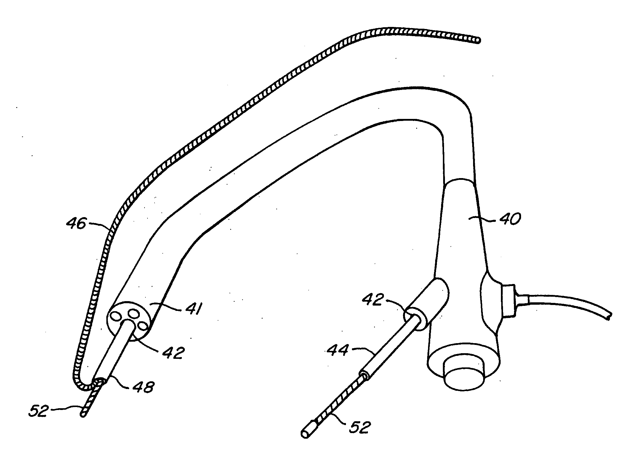 Lung access device