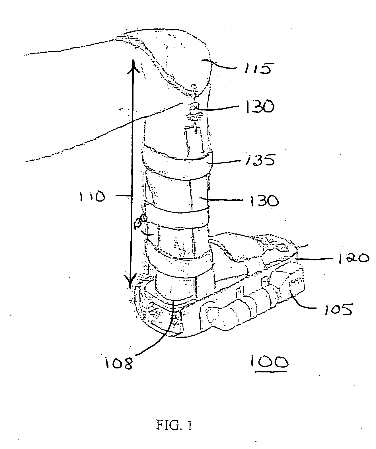 Musculosketal loading device