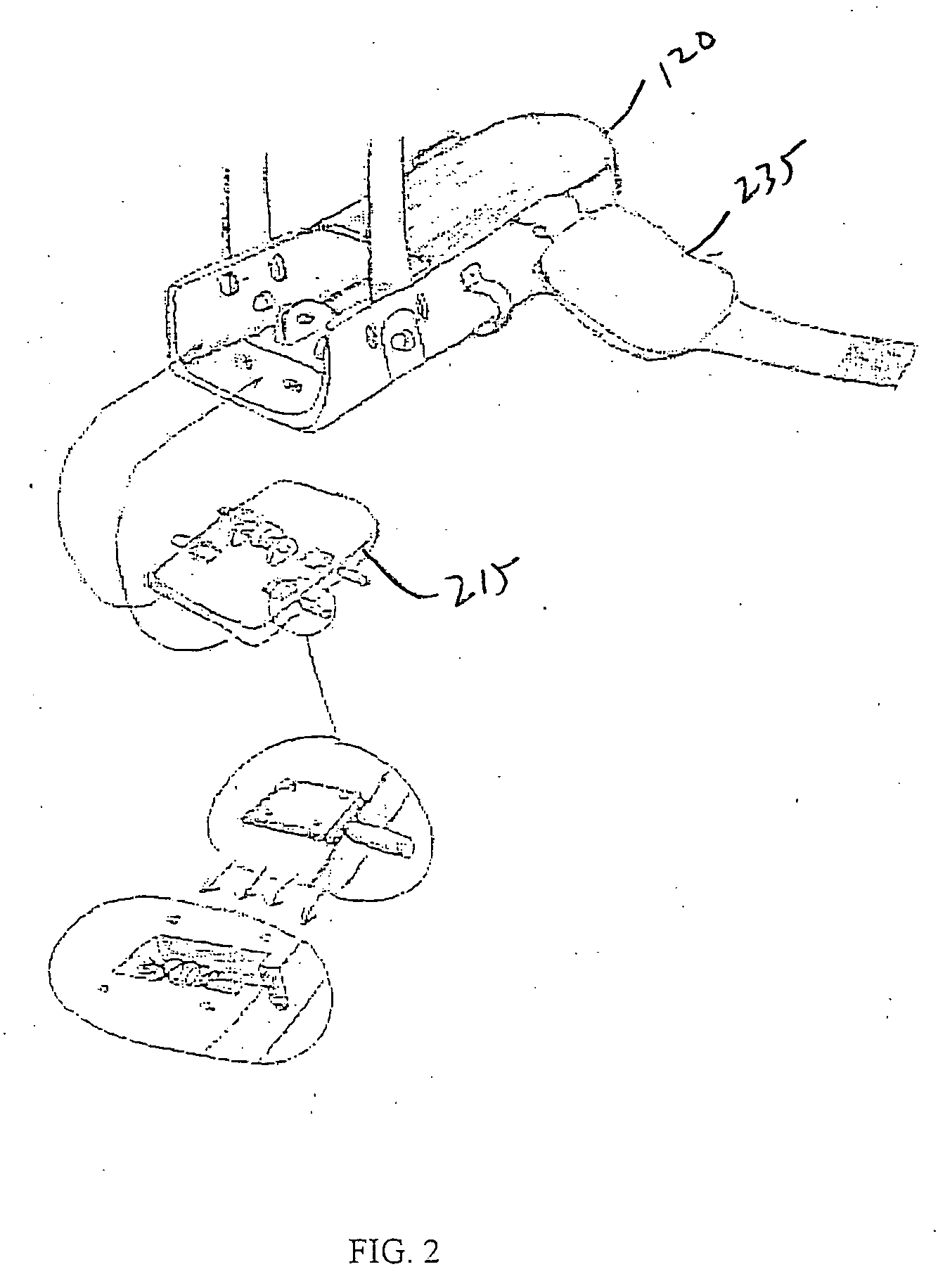 Musculosketal loading device