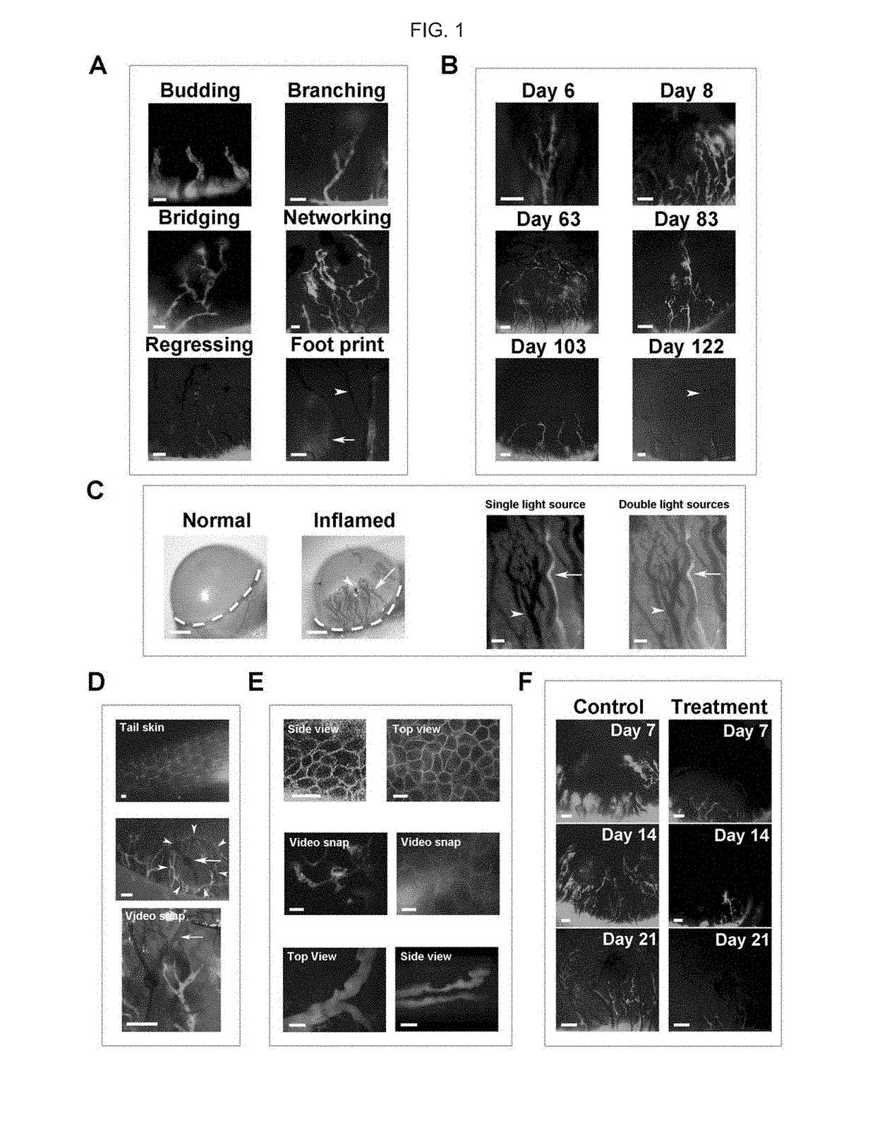 In vivo visualization of lymphatic tissue