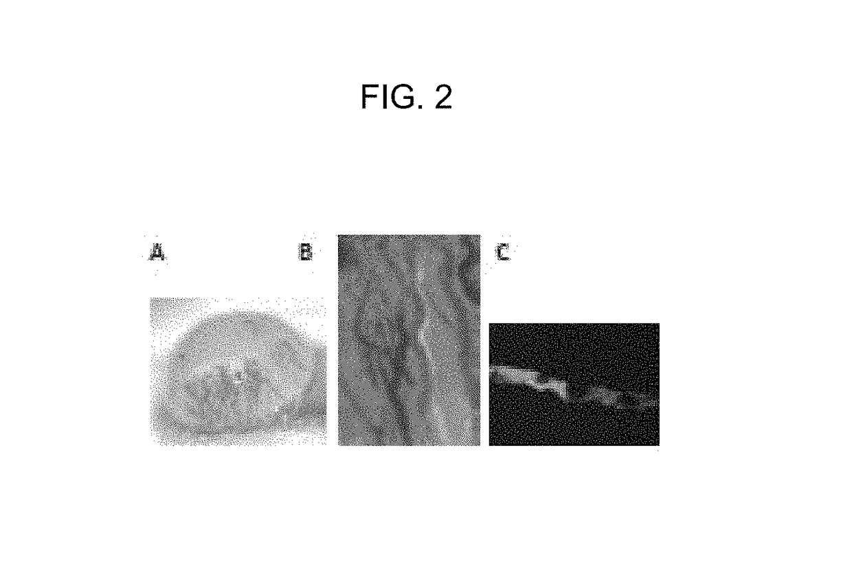 In vivo visualization of lymphatic tissue