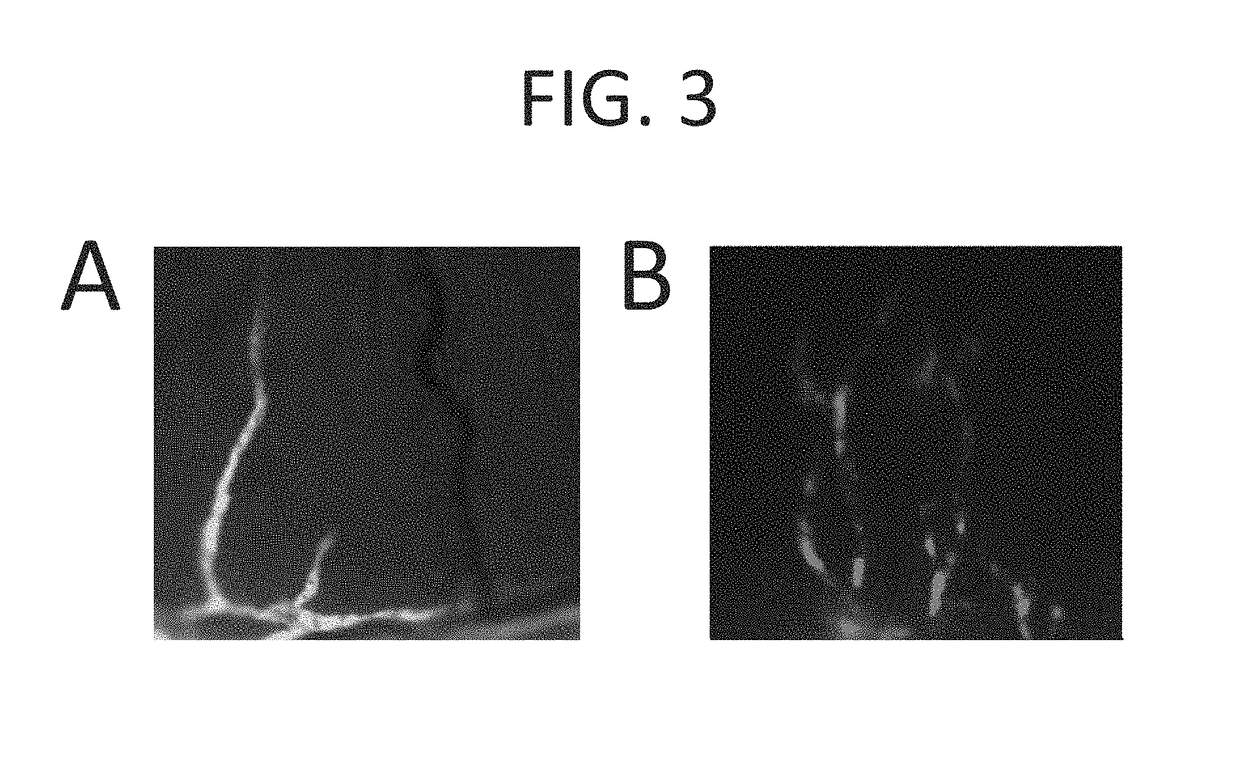 In vivo visualization of lymphatic tissue