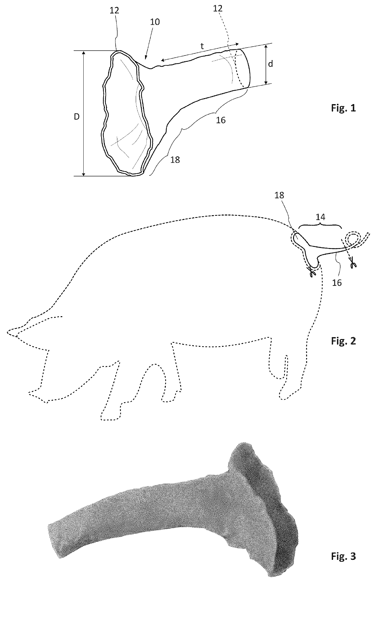 Biological prosthesis intended for the treatment of parastomal hernias