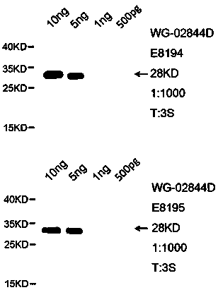 Preparing method of grass carp complement 5 polyclonal antibody