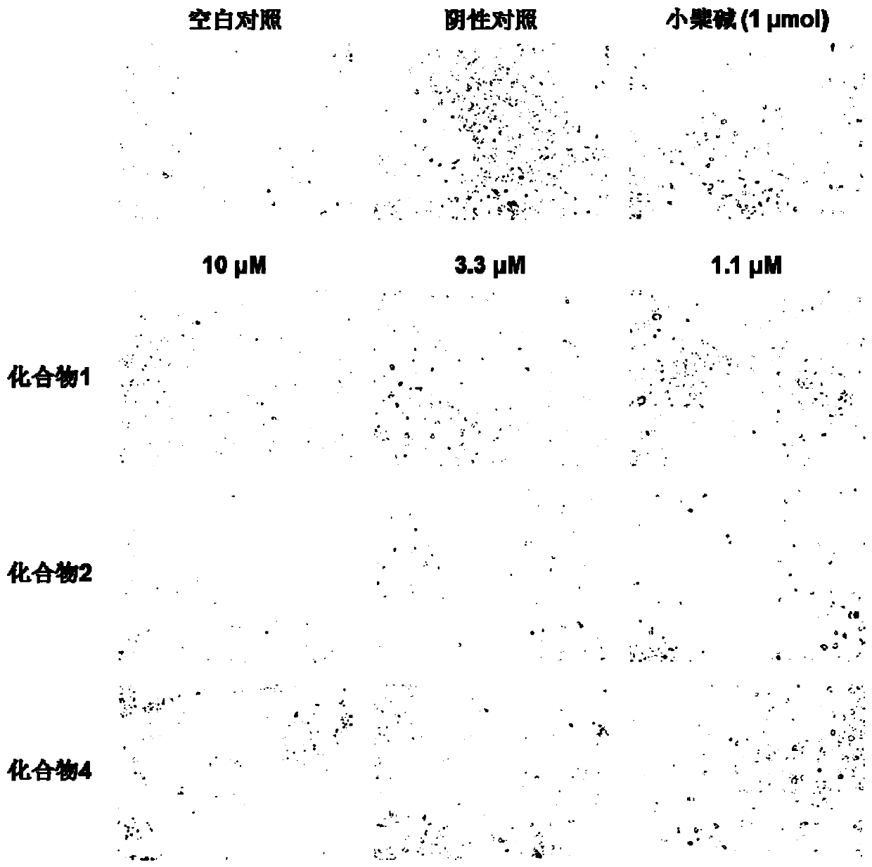 An anti-obesity drug containing wild chrysanthemum extract