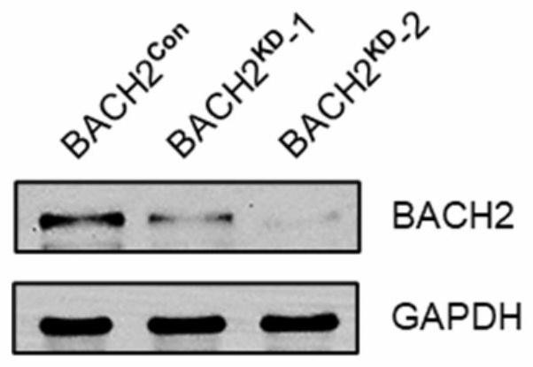 Application of cytarabine and proto-oncoprotein c-FOS inhibitor in preparation of product for treating leukemia