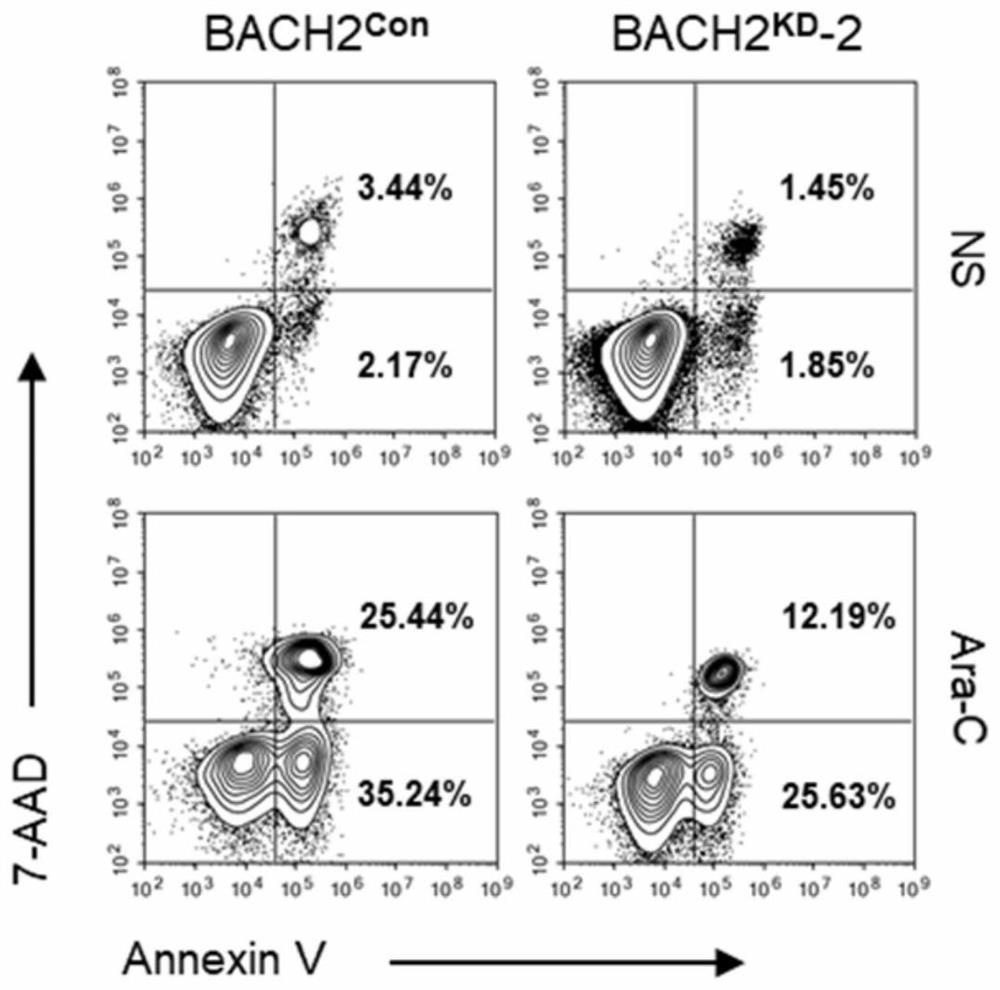 Application of cytarabine and proto-oncoprotein c-FOS inhibitor in preparation of product for treating leukemia