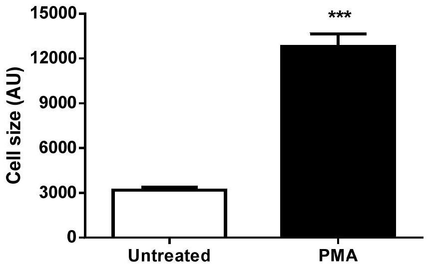 A method for establishing a "human-derived" cardiac hypertrophy model based on pluripotent stem cell technology