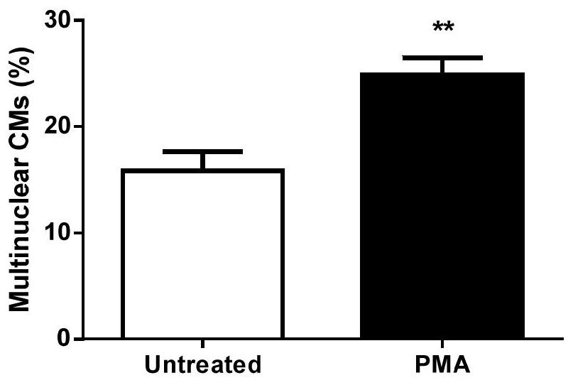 A method for establishing a "human-derived" cardiac hypertrophy model based on pluripotent stem cell technology