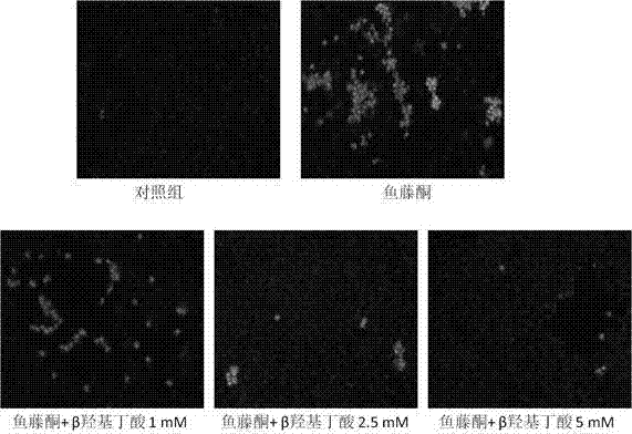 Application of beta hydroxybutyric acid in treatment of Parkinson disease