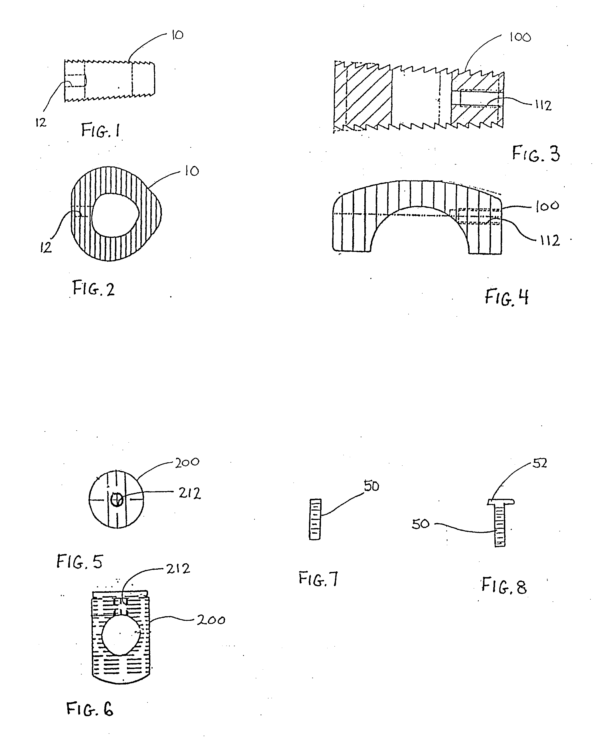 Osteoimplant and Method for Making Same