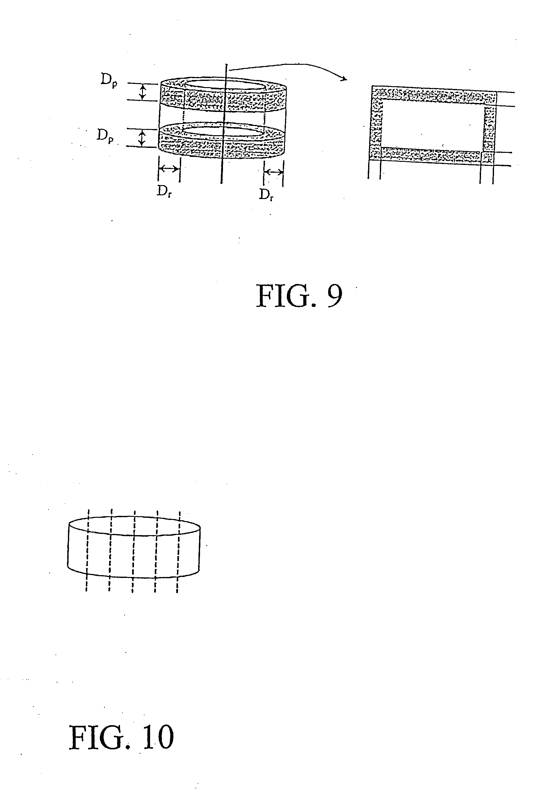 Osteoimplant and Method for Making Same