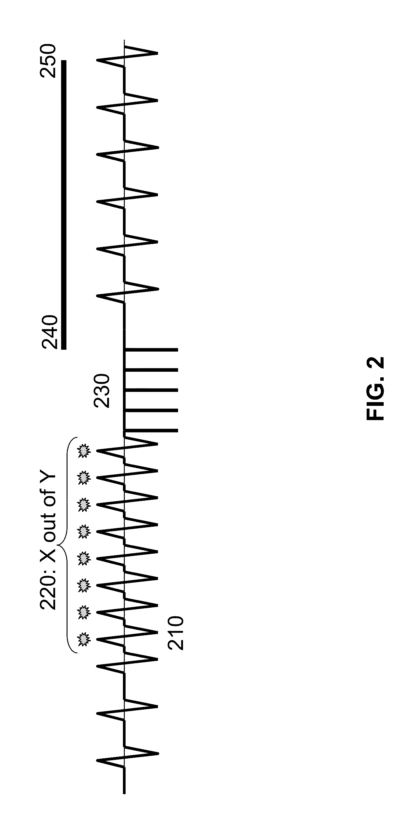 Implantable cardioverter-defibrillator including arrhythmia detection criteria