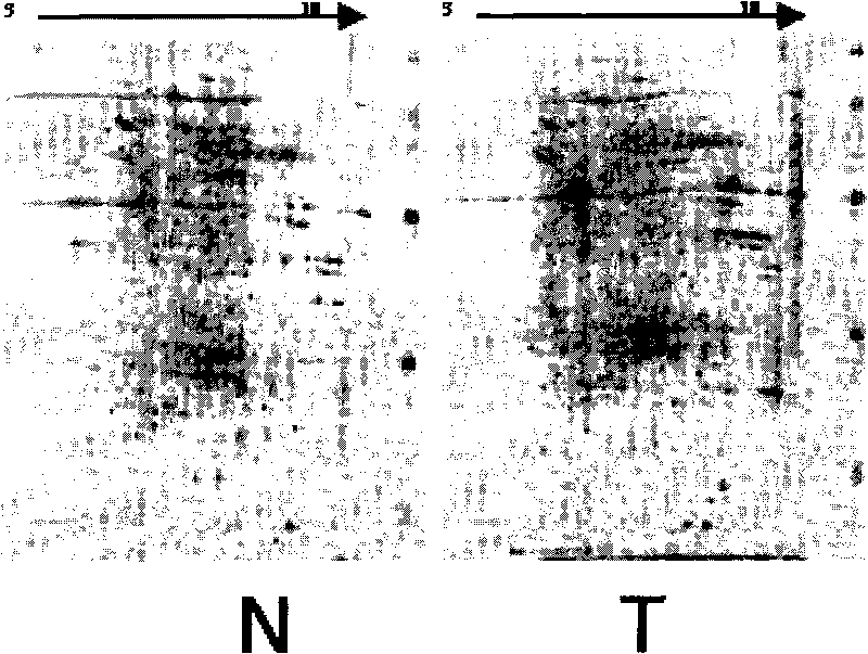 AMP-18 antigen polypeptide and application in preparing medicament for treating tumor