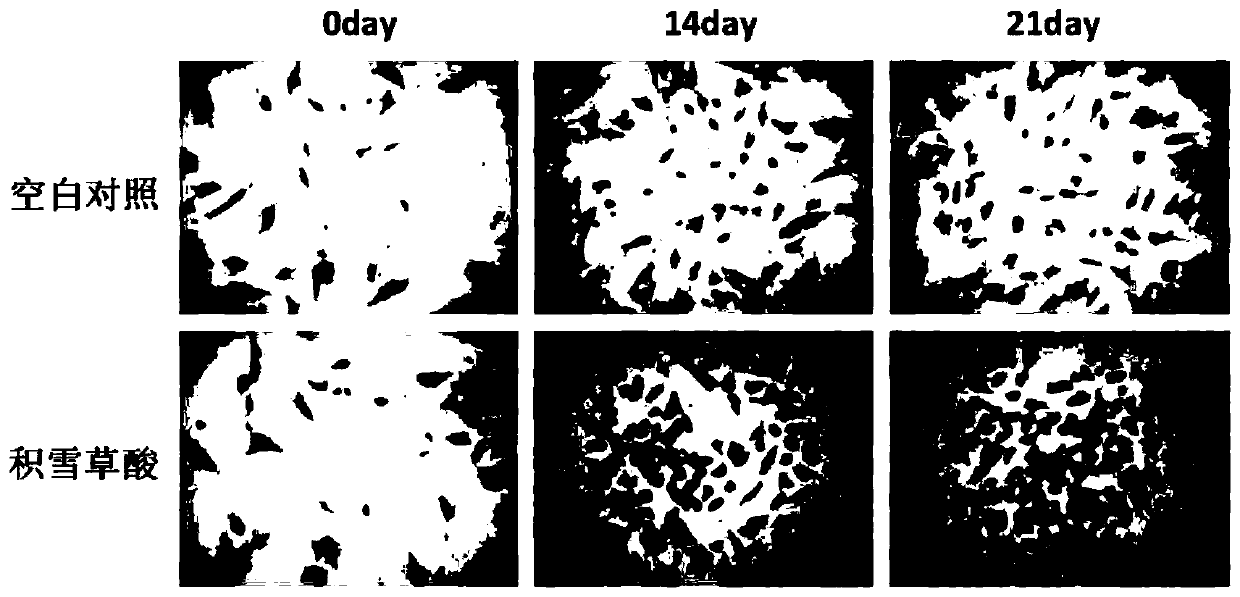 Application of asiatic acid to promotion of in vitro proliferation of human adipose mesenchymal stem cells and induction of chondrogenic differentiation of human adipose mesenchymal stem cells