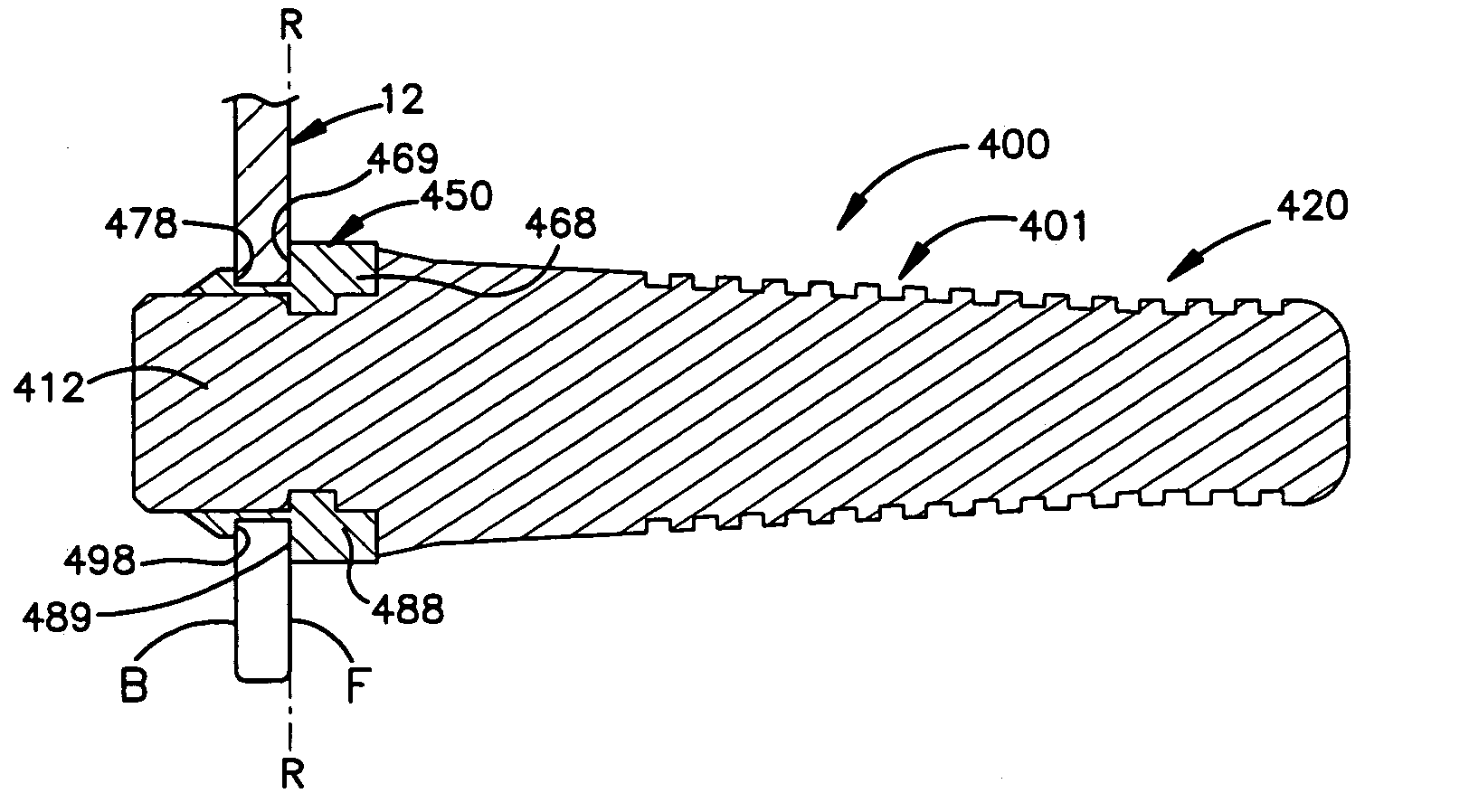 Poultry picking finger and mounting structure