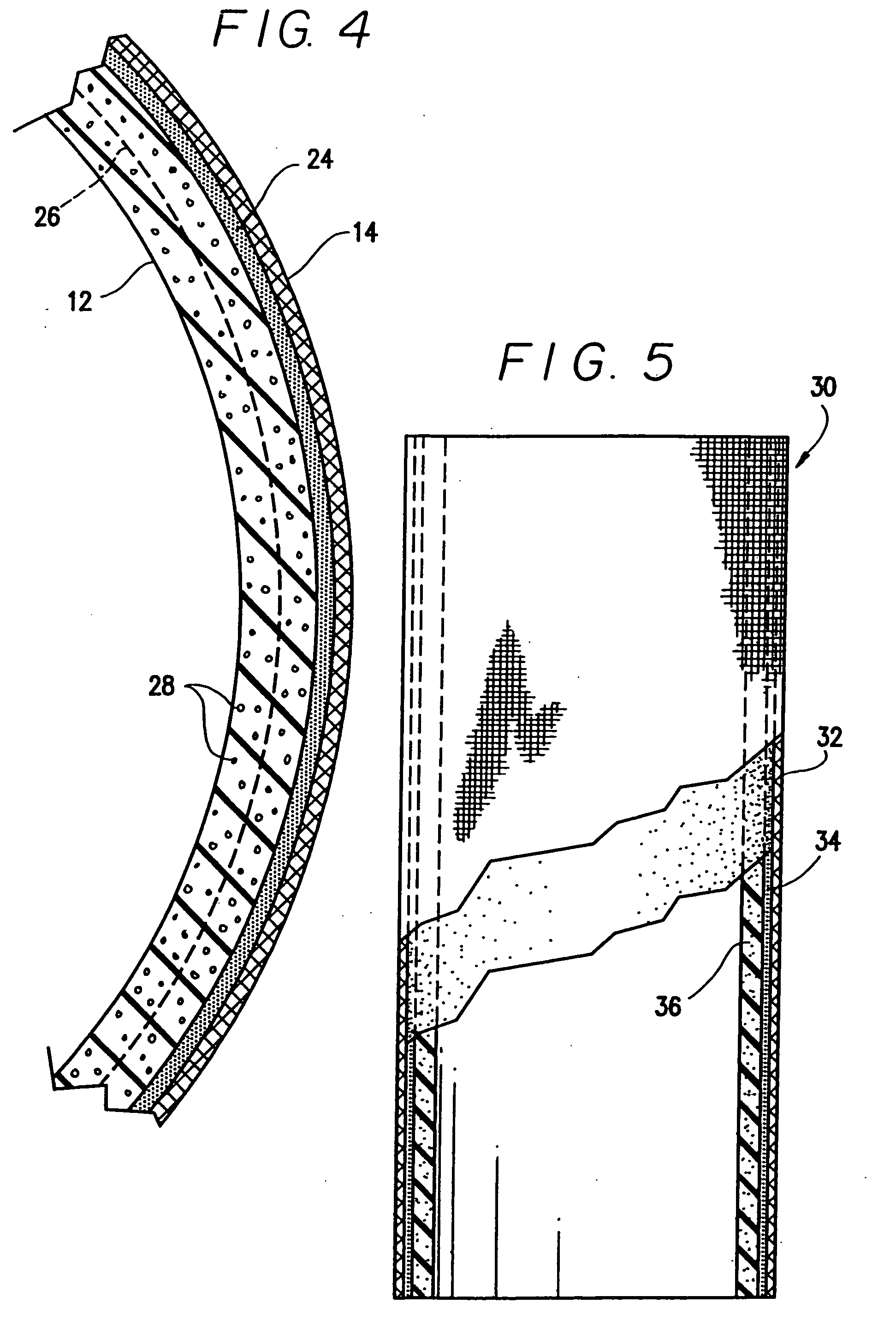 Prosthetic liner