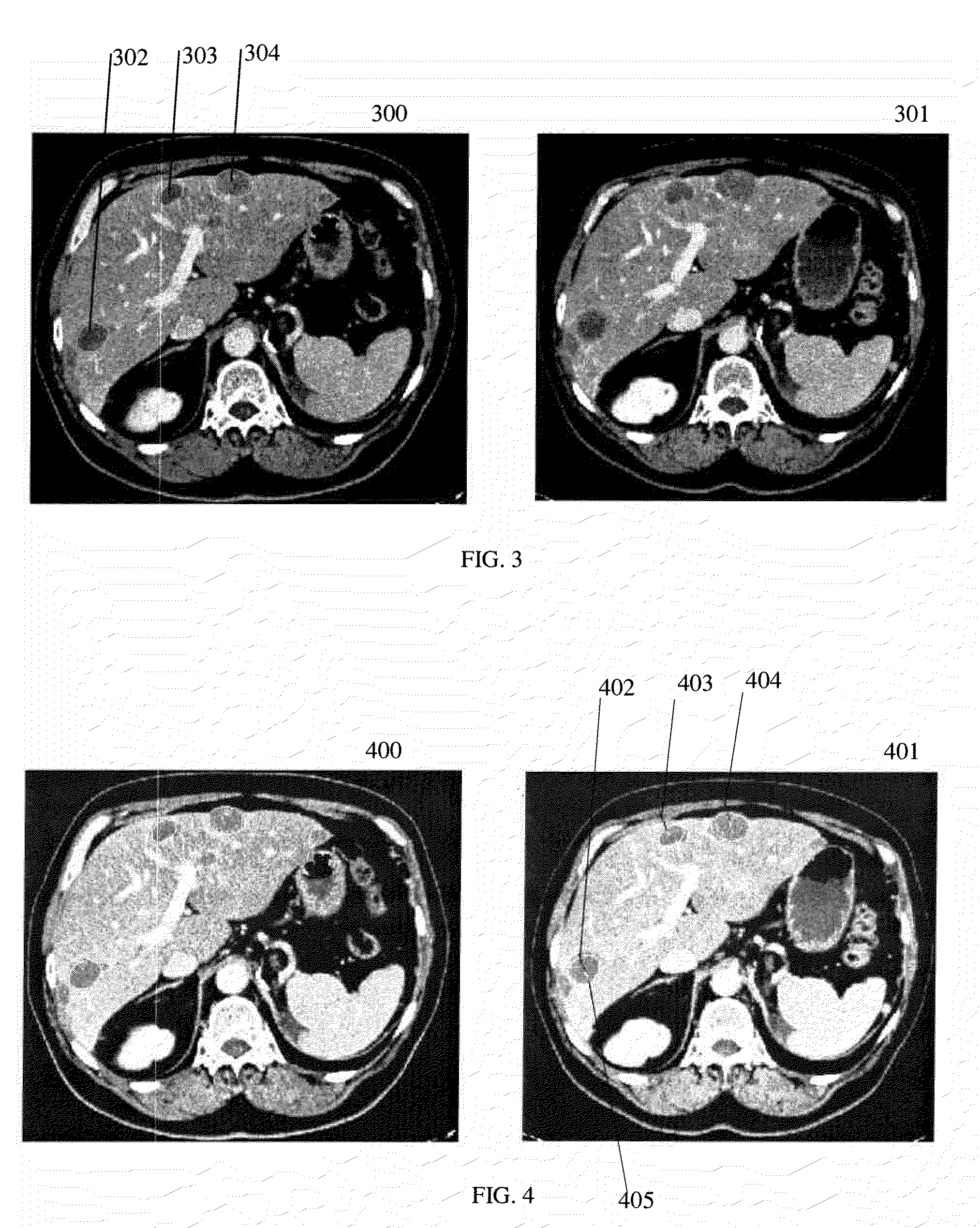 Combined segmentation and registration framework for parametric shapes