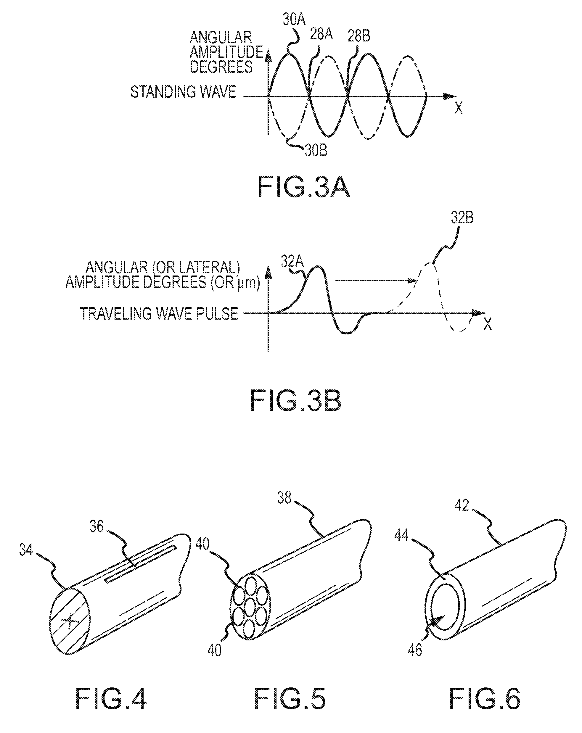 Ultrasonic endovascular clearing device