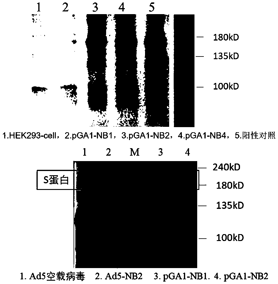 Adenovirus vector vaccine for preventing SARS-CoV-2 infection