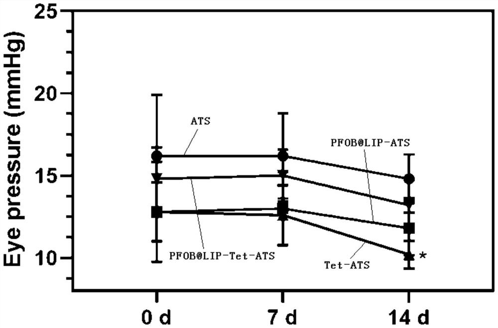 Tetrandrine-loaded liposome preparation as well as preparation method and application thereof