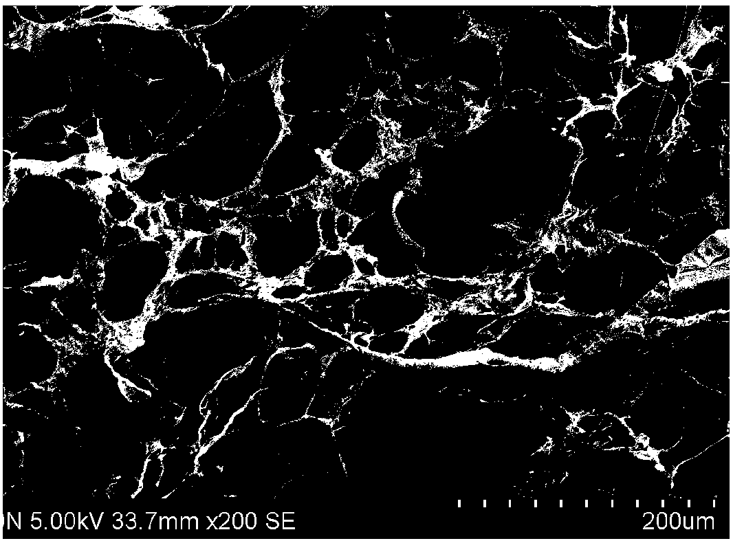 Exosome targeted slow-release microsphere biological stent and preparation method and use thereof